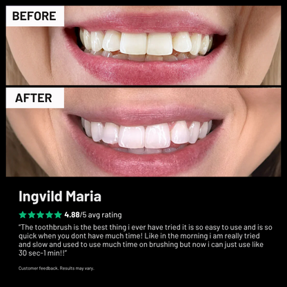 RADI Automatic Toothbrush